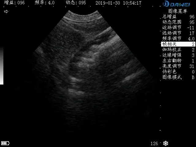 犬脾臟b超圖像
